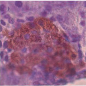 Insulin-K