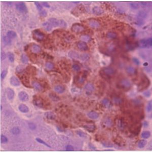 Insulin-K_probiotik