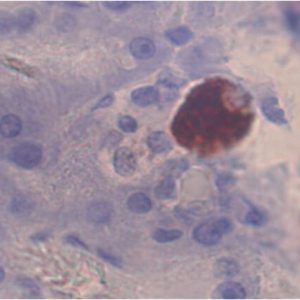 Insulin-STZ