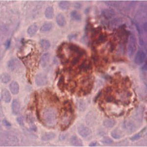 Insulin-STZ_probiotik